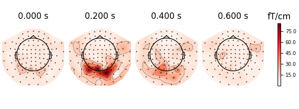 0.000 s, 0.200 s, 0.400 s, 0.600 s, fT/cm